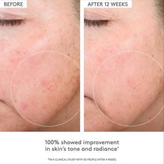 C-Firma Fresh Vitamin-C Day Serum